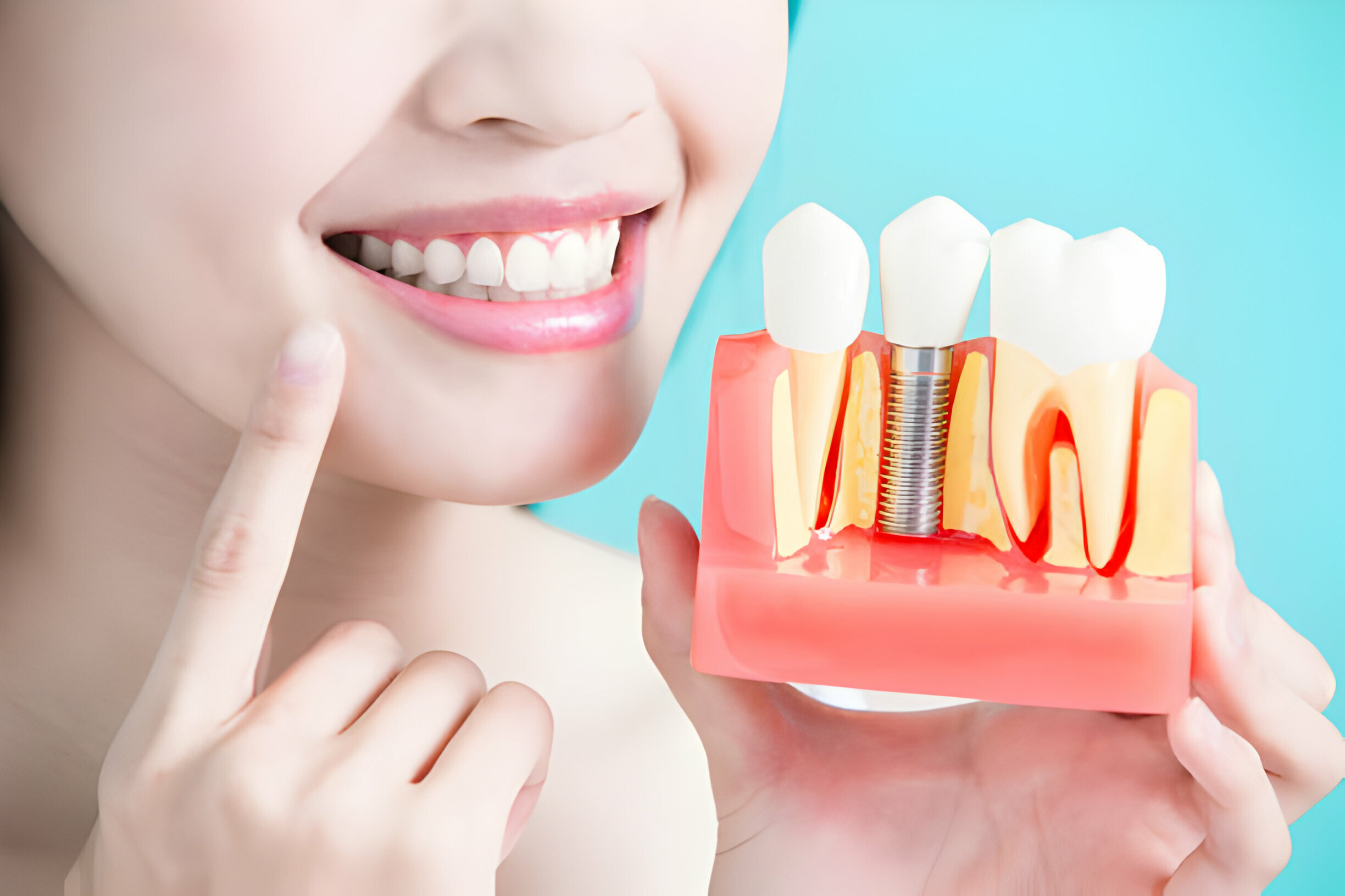 Understanding Your Restorative Dentistry Options In Dallas, GA_1