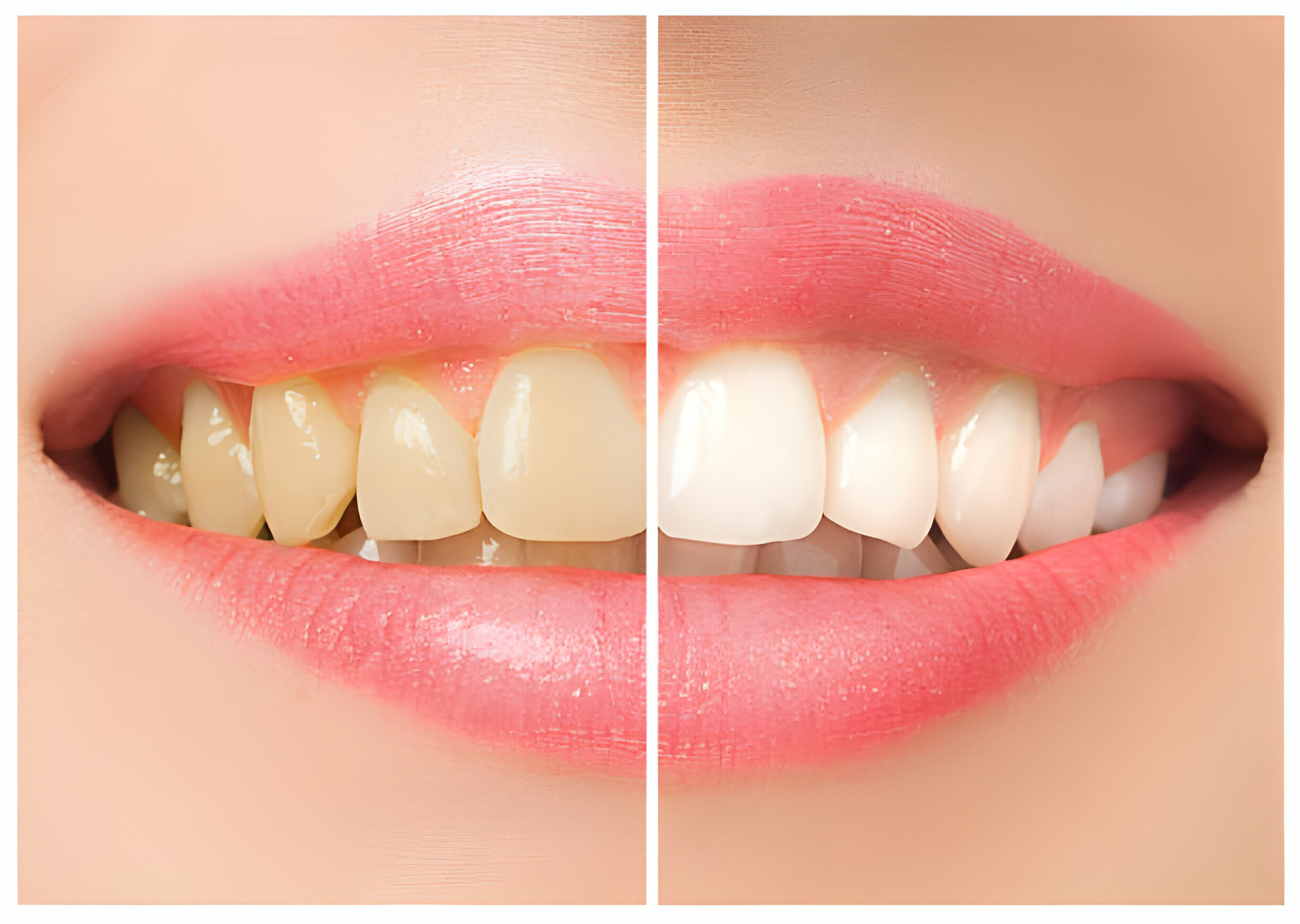 5 Reasons To Visit A Dallas, GA, Cosmetic Dentist_FI