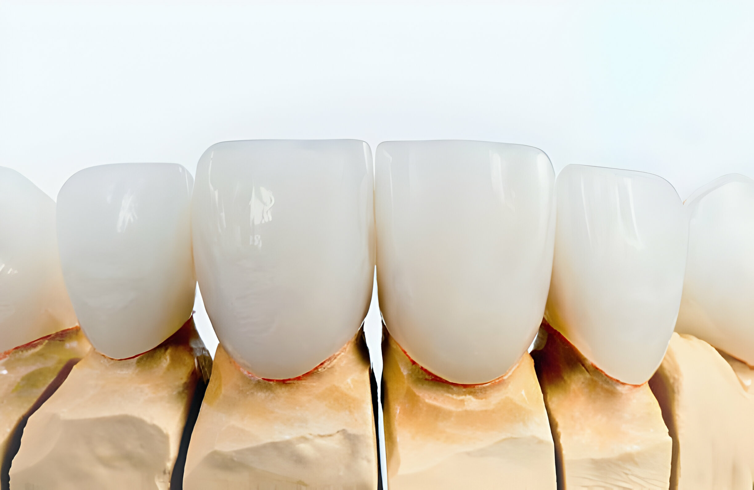 Basic Restorative Dental - What is it About?_FI
