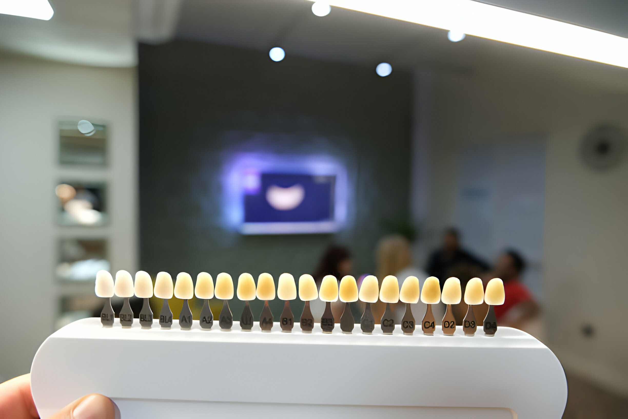 7 Things to Consider Before Getting Veneers in Dallas, GA_FI