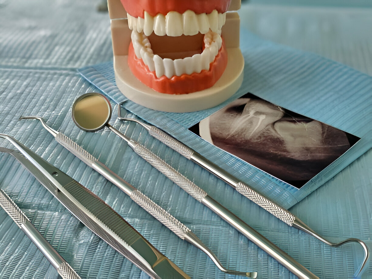 Restorative Dentistry Solutions for Common Dental Issues: Expert Advice from Seven Hills Dentist in Dallas, GA_FI