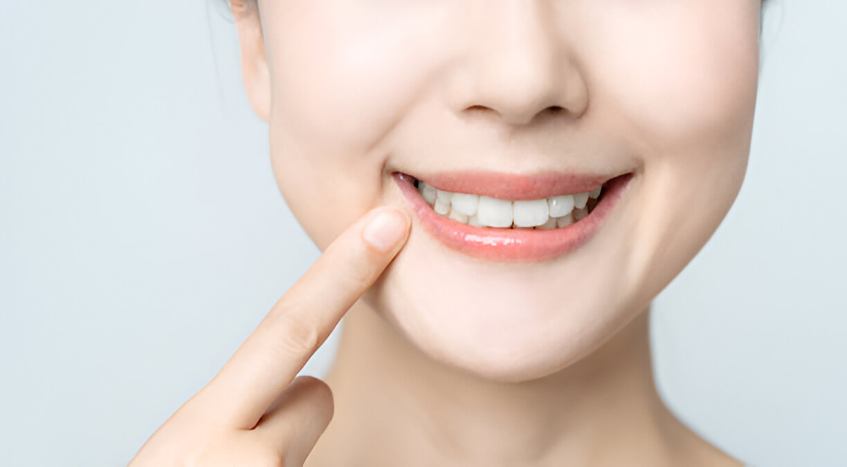Expert Teeth Whitening Services at Seven Hills Dentistry: Your Trusted Dentist in Dallas, GA_FI