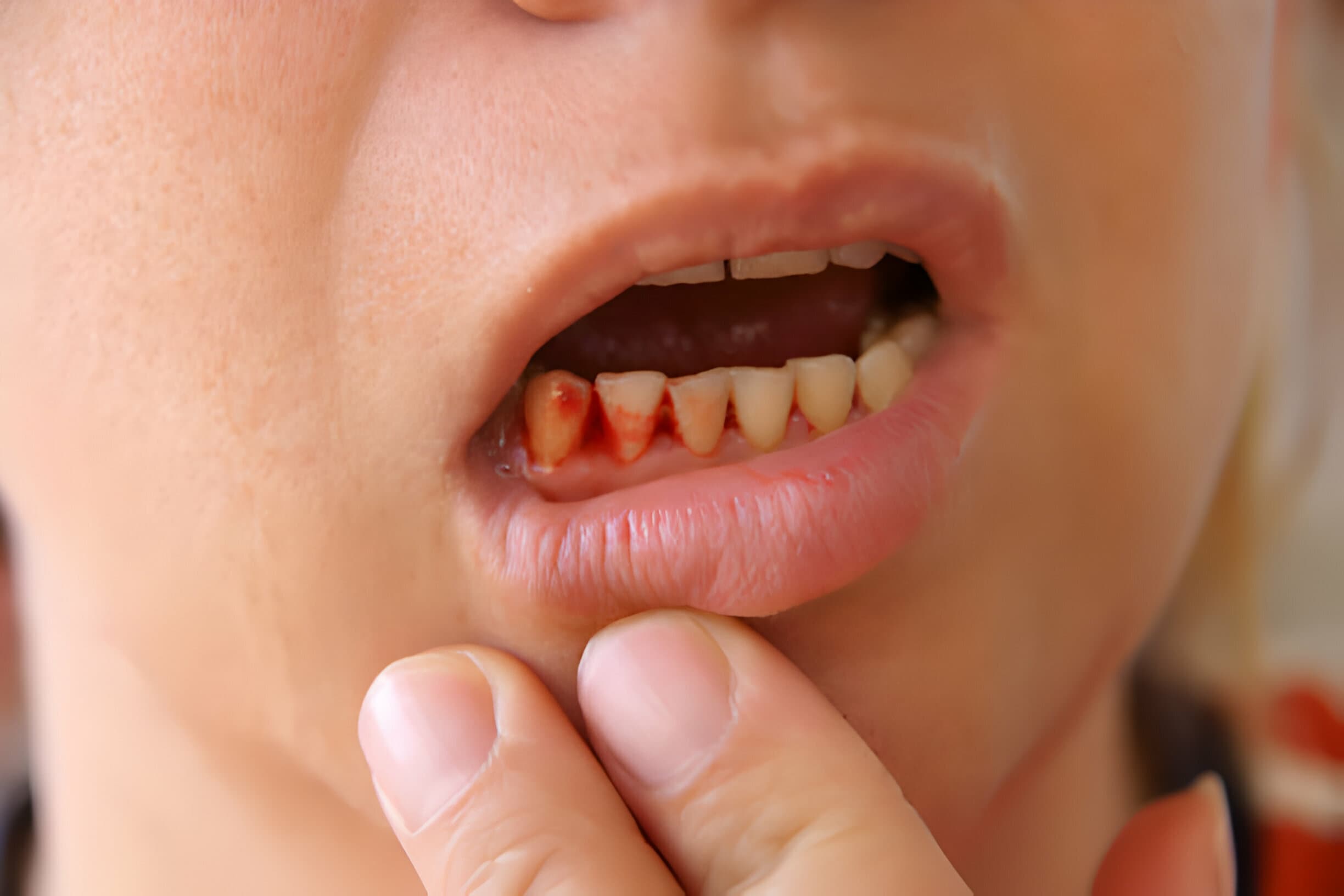 7 Common Dental Emergencies and How to Handle Them_2