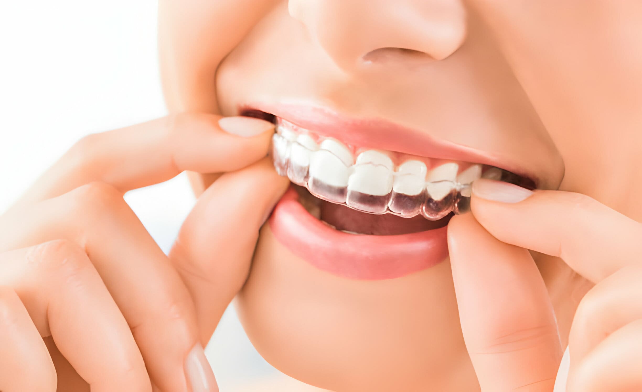 5 Reasons To Visit A Dallas, GA, Cosmetic Dentist_3