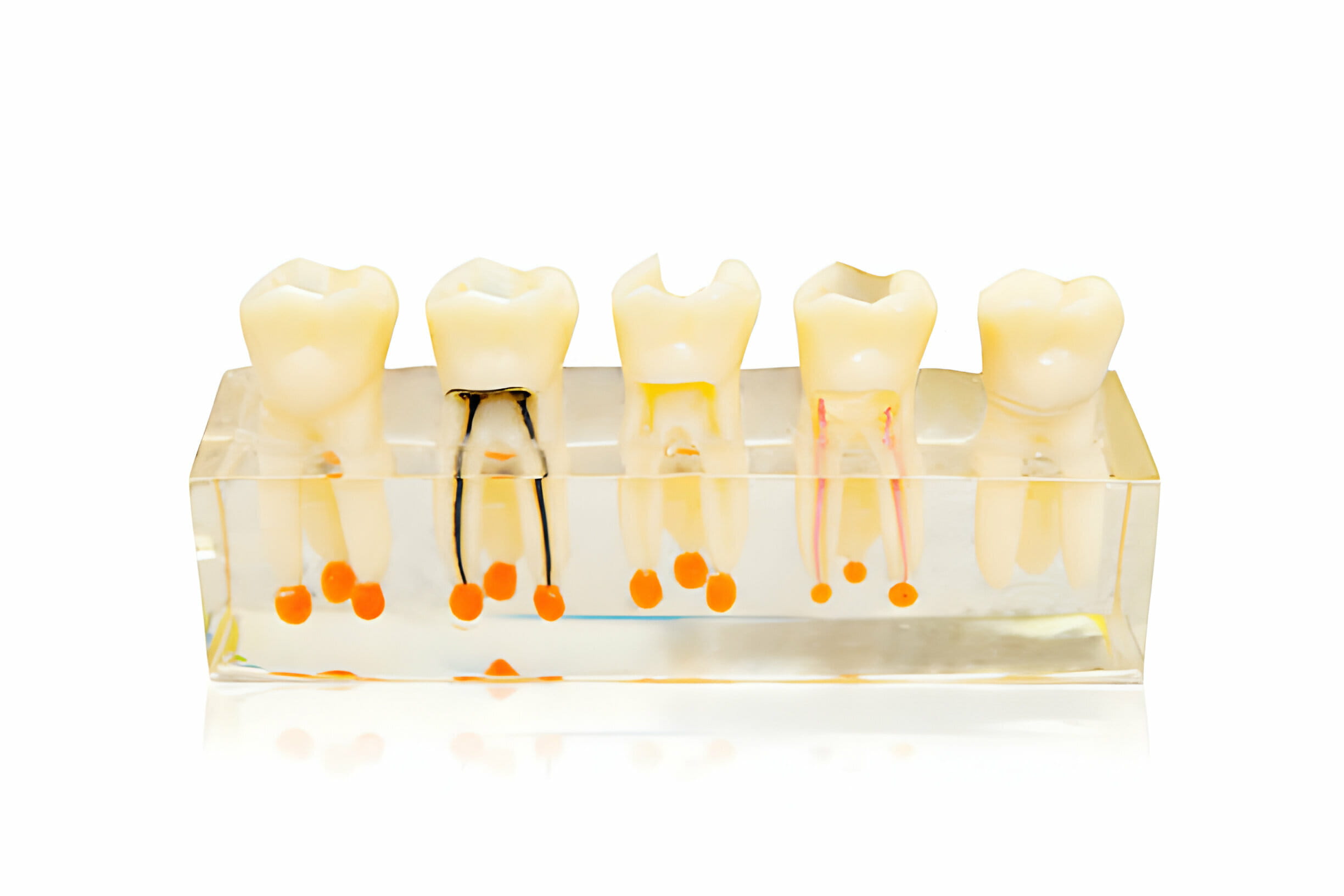 Finding the Best Dental Implant Specialist: Tips and Insights_1