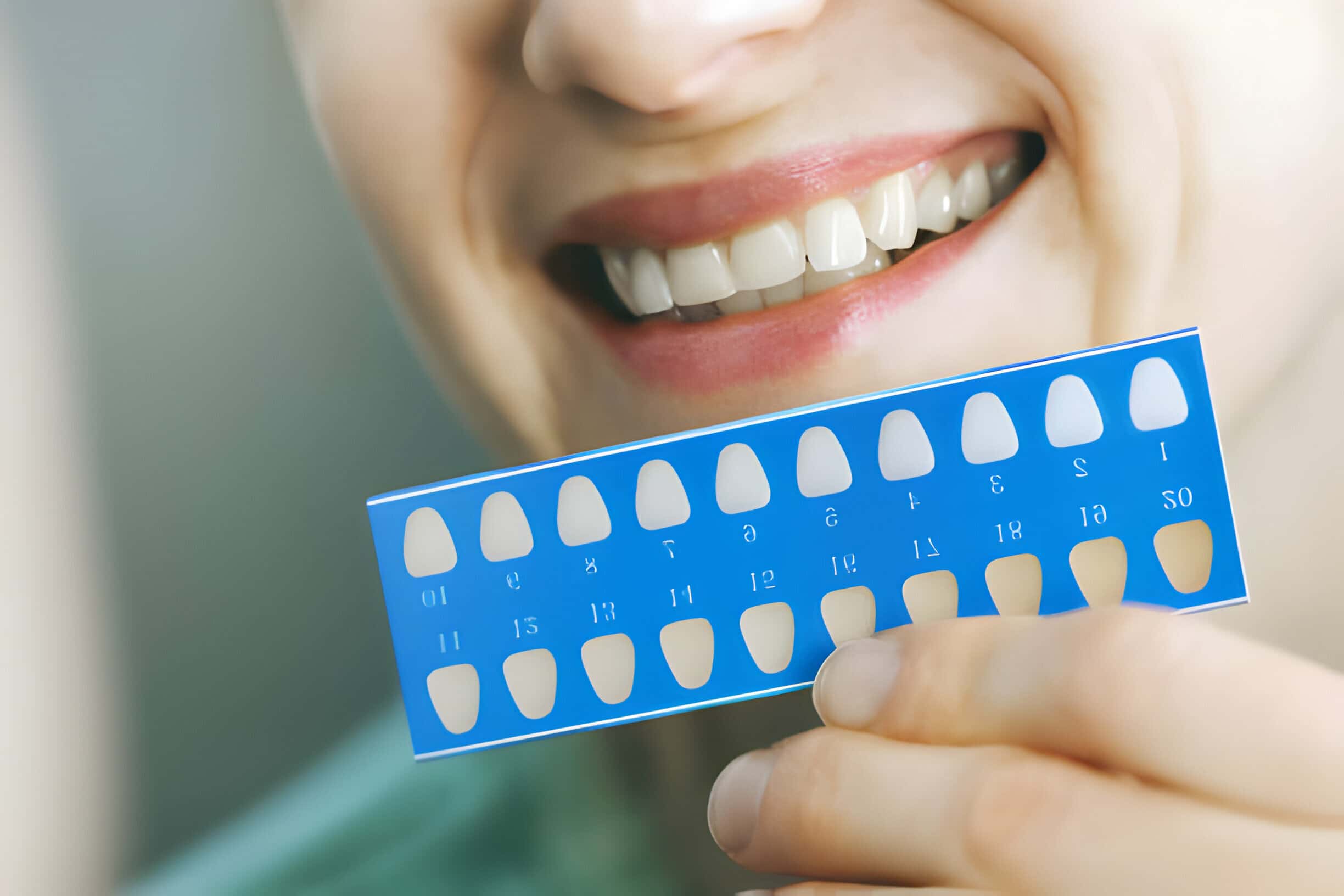 7 Things to Consider Before Getting Veneers in Dallas, GA_2