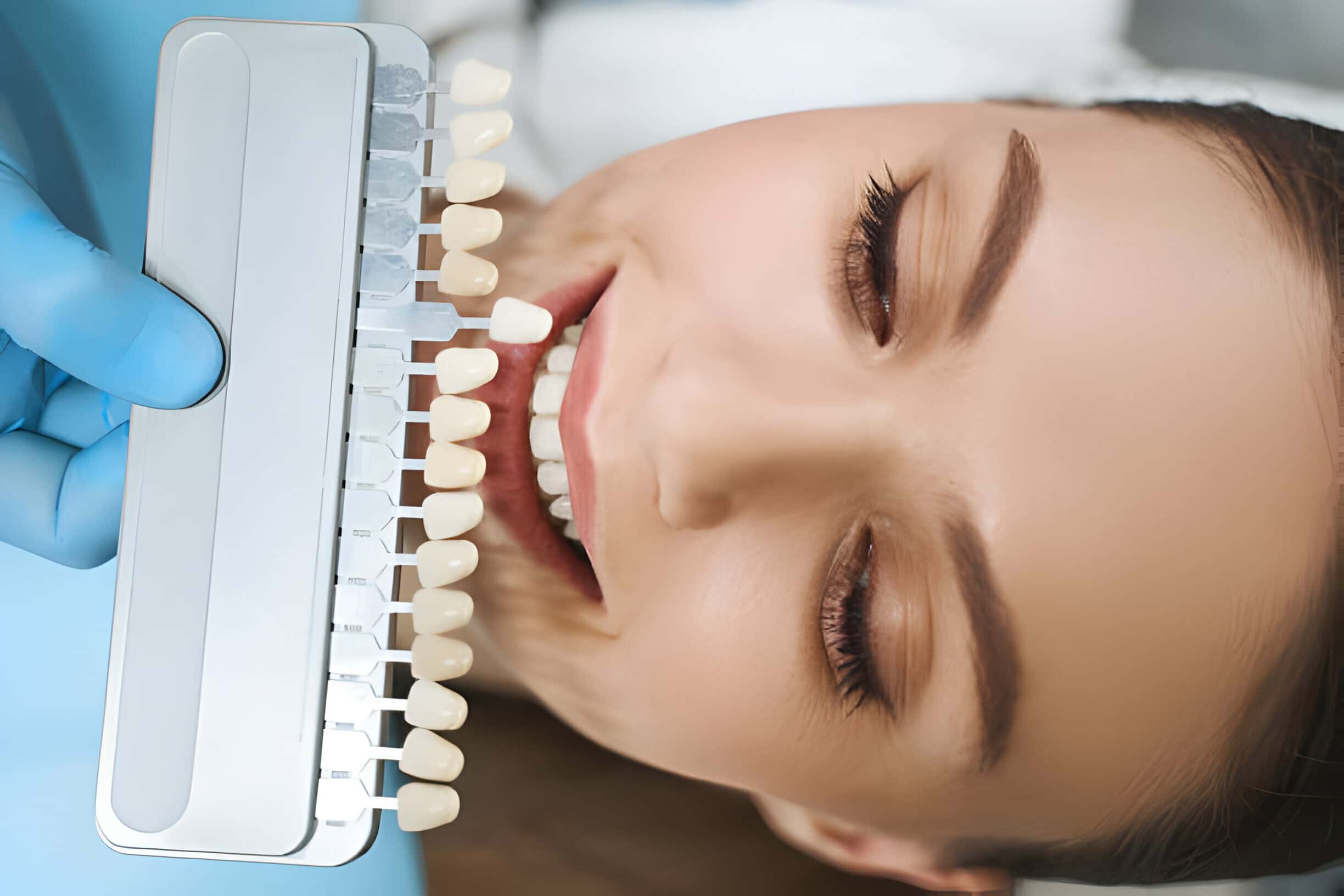 7 Things to Consider Before Getting Veneers in Dallas, GA_3