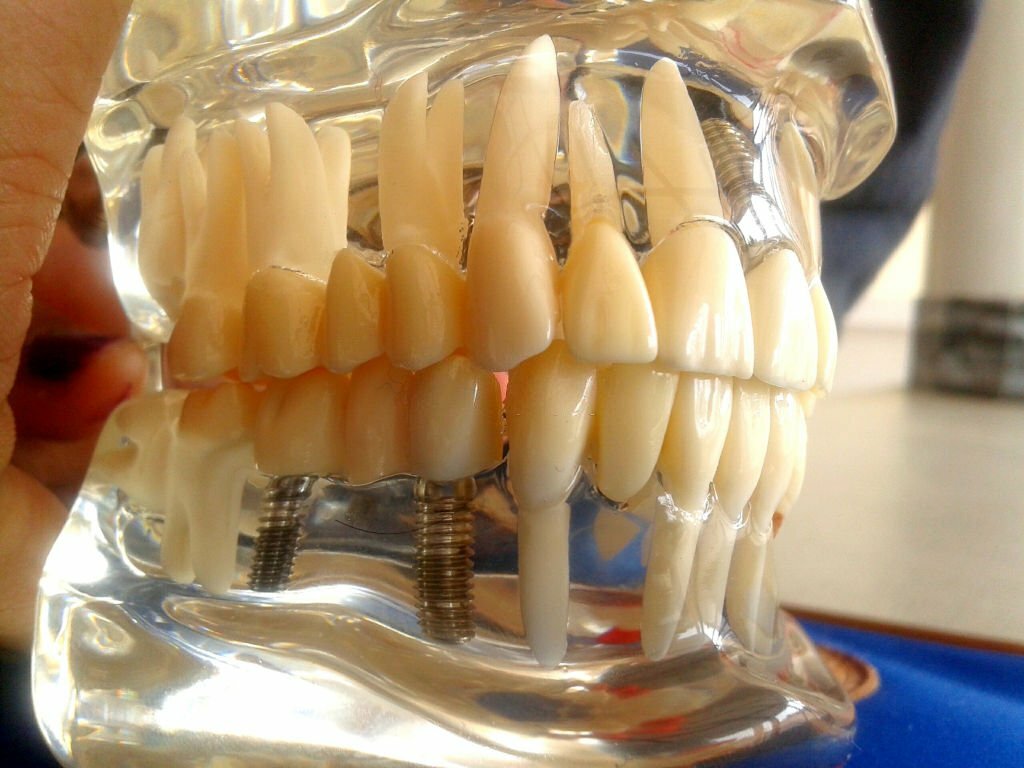 Gum Disease
