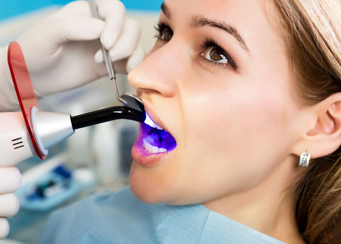 Tooth bonding for quick cosmetic improvements