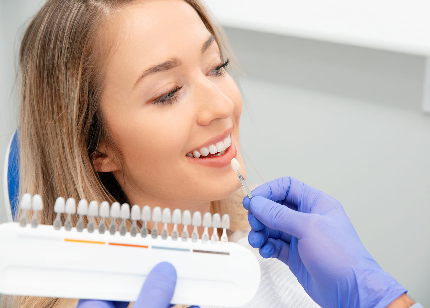 Veneers for improving smile appearance