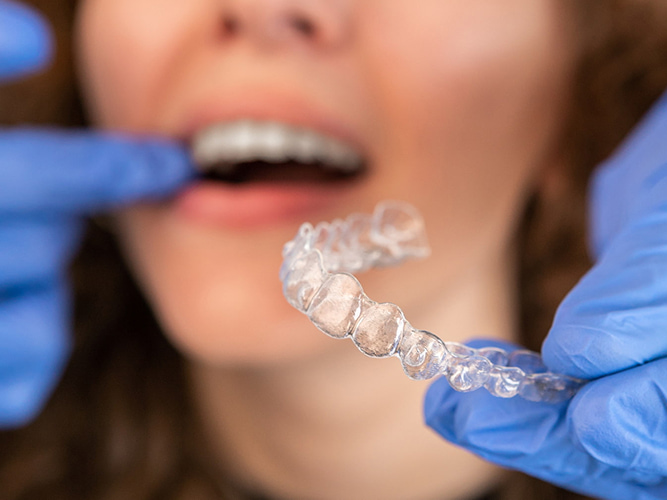 Invisalign®