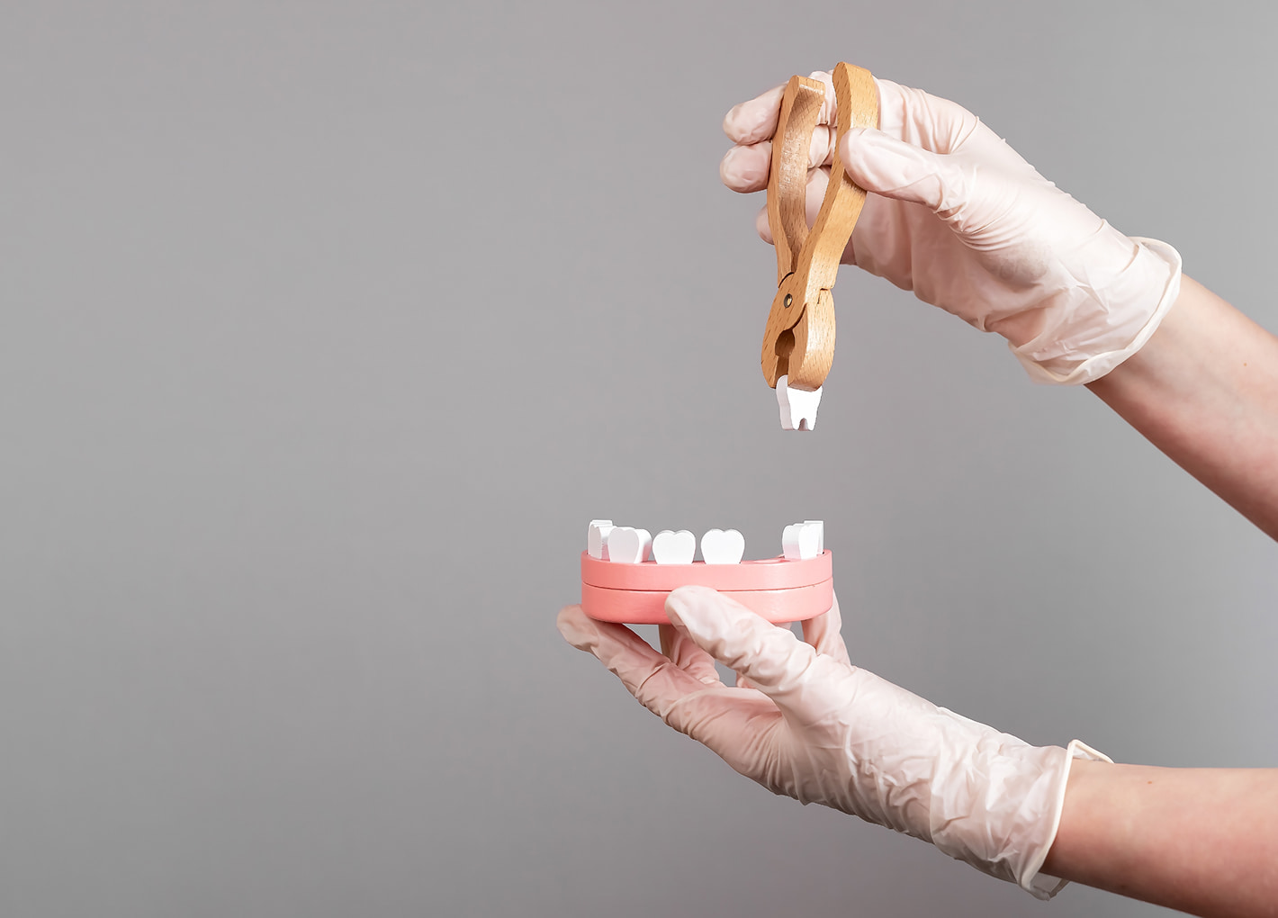 Extractions