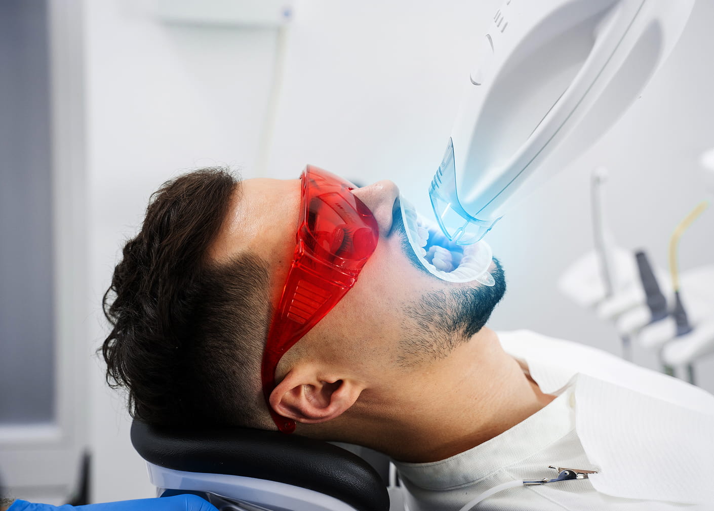 Teeth whitening for special events or everyday confidence